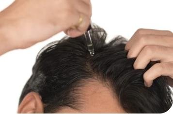 Applying hair oil to the scalp with an applicator