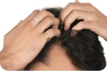 Gently massaging hair oil into the scalp with fingertips